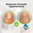 thumbnail image 5 of Troya Sani NailsToenail Repair Hydrating and Restoring Brush-On Toenail Solution with Copaiba Tree Oil, (2 Pack), 5 of 7