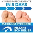 thumbnail image 2 of Imperial Feet Antifungal Skin Cream - Athletes Foot Treatment - Jock Itch Cream Extra Strength - Ringworm Treatment for Humans - XL - Used by Professionals, 2 of 8