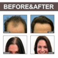 thumbnail image 4 of Hair Dense Essential Oil Repair Dry Hair And Impetuous Hair, Strengthen Hair And Prevent, 4 of 4