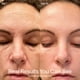 thumbnail image 4 of Solawave Varita de renovación radiante 4 en 1 para el cuidado de la piel con masajeador facial (oro rosa), 4 of 9