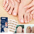 thumbnail image 3 of Guardurnaity Paquete de 50 parches para uñas de los pies, impermeables, adhesivos encarnados, cómodos, recortables, alisadores, pegatinas de recuperación, Arte de uñas Guardurnaity CE013547-00, 3 of 6