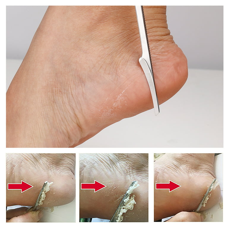 Pedicure Foot Shaver Callus Remover - Chainplus Professional Heel Callous  Corn Removal Metal Scraper with 10 Blades - Hand Dry Dead Skin File 