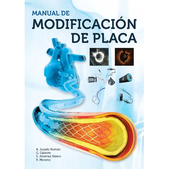 Manual de modificación de placa Blanco