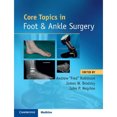 Core Topics in Foot and Ankle Surgery - eBook