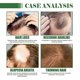 thumbnail image 3 of Batana Oil for Hair Growth, 100% Pure Batana Oil Natural Hair Growth Treatment Oil cares for hair thickness and scalp and prevents hair loss, 3 of 5