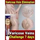 thumbnail image 2 of Tratamiento para el dolor de venas varicosas a base de hierbas, alivio de la hinchazón de las venas, eliminación de la Varicocele, promueve el flujo sanguíneo, 2 of 5