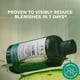 thumbnail image 4 of Limpiador facial The Body Shop Tea Tree Skin Clearing, 250 ml, vegano, 4 of 8