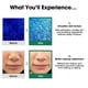 thumbnail image 5 of Tónico facial SOME BY MI AHA BHA PHA 30 Days Miracle 150 ml, 5 of 8