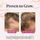 thumbnail image 3 of Hair Growth Supplements for Women, Thicker Fuller Hair Support for Thinning Hair and Hair Loss, 3 of 5