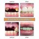 thumbnail image 4 of 2024 New Diy Denture Kit, Denture Diy Kit Is Simple And Convenient Diy Denture Repair Missing, 4 of 5