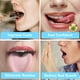 thumbnail image 3 of Paquete de 4 raspadores de lengua, limpiadores de lengua de acero inoxidable para un aliento fresco, 3 of 4