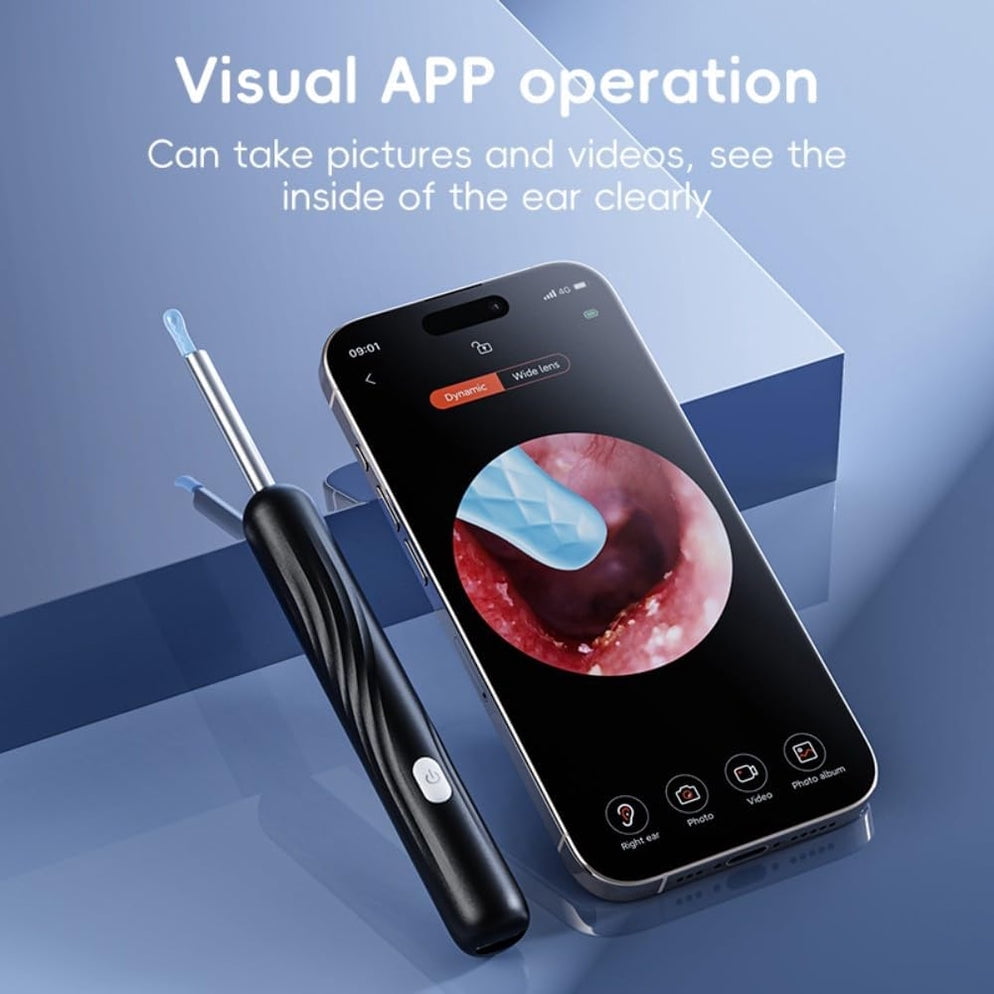Ear Wax Removal with 1080P HD Camera Otoscope Ear Cleaning Kit - White