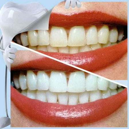 scaler ultrasonic calculus
