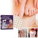 thumbnail image 2 of EELHOE 50Pcs Elastic Ingrown Toenail Correction Stickers Elastic Adhesive Relieve Feet, 2 of 5