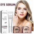 thumbnail image 1 of Jaysuing Eye Care Cream Reduces Fine Lines, Dark Circles, Eye Bags, Hydrating, Moisturizing And Firming Eye Cream, Anti-aging Skin Care, 1 of 5