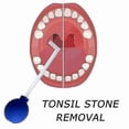 thumbnail image 5 of Tonsil Stone Remover,tonsil Stone Removal Tool Kit,tonsil Stone Water Flosser,tonsilitis & Halitosis Treatment, 5 of 5