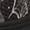 Bat Spider Web Moon Star, variant on Pointodoor Rainbow Web Shoes for Kids Boys Size 11.5 Causal Single Buckle Sneakers Anti Slip Rubber Sole Running Tennis Lightweight Knitted Mesh Athletic Shoes