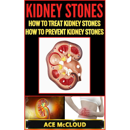 Kidney Stones: How To Treat Kidney Stones: How To Prevent Kidney Stones -