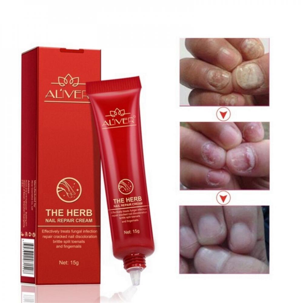 Nail Care Treatment Herbal Nail Repair Cream Anti Fungal Nail Chinese