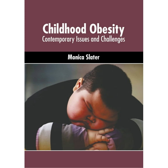 Childhood Obesity: Contemporary Issues and Challenges, (Hardcover)