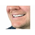 thumbnail image 4 of Instant Smile Flex 2pk - Bright White Shade - One Size Fits Most. Fix Your Smile at Home in Minutes! Comfortable Upper Cosmetic Veneer for A Perfect Smile!, 4 of 8