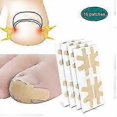thumbnail image 2 of Pedicure Tools - Ingrown Toenail Corrector Stickers For Paronychia Recovery, 2 of 5