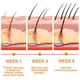 thumbnail image 4 of Aceite esencial para el cabello con agua de arroz EELHOE, 4 of 10