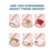 thumbnail image 1 of Pegatinas correctoras para uñas Parches correctores para uñas encarnadas Tratamiento para paroniquia Recuperación Alivio de la involución de las uñas Cuidado de los pies, 1 of 4