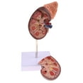 thumbnail image 3 of Modelos s De Riñón , Riñón De Tamaño Natural Con Modelo De Glándula Suprarrenal, 2 Partes Extraíbles Hugo Estatua humana del riñón, 3 of 9