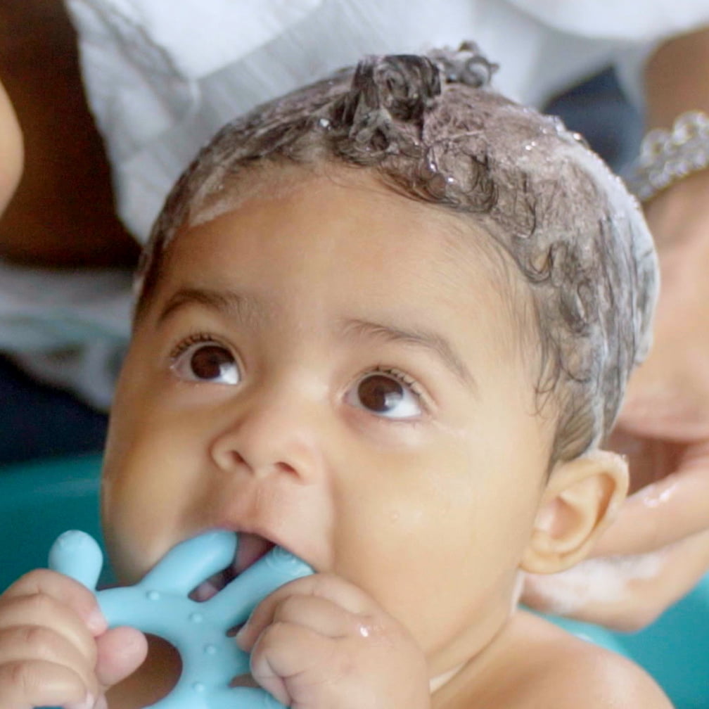 bella bee gone cradle cap