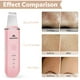 thumbnail image 5 of Skin Scrubber MISERWE Facial Scrubber Limpiador de poros, color rosa, 5 of 7