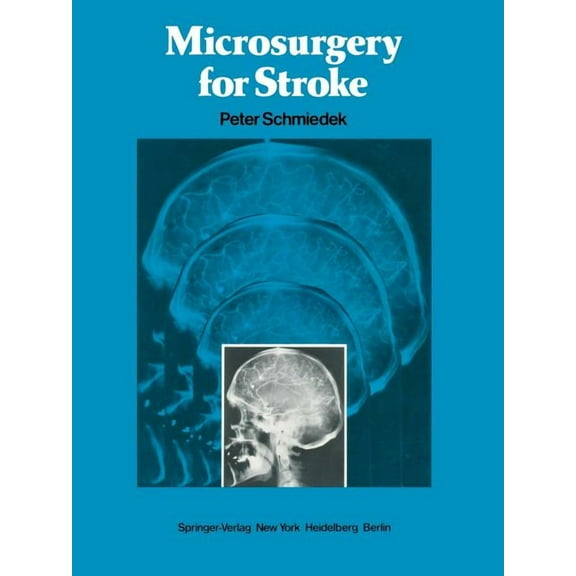 Microsurgery for Stroke, (Paperback)