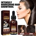thumbnail image 3 of Solución nutritiva natural para el cabello de aceite de coco para el crecimiento del cabello de 30 ml para el cuidado de las mujeres y los hombres, 3 of 9