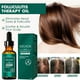 thumbnail image 5 of Aceite para la foliculitis del cuero cabelludo, aceite capilar, aceite natural para cabello y cuero cabelludo, nutritivo para puntas abiertas y cuero cabelludo seco para todo tipo de cabello 30 ml Ese, 5 of 9