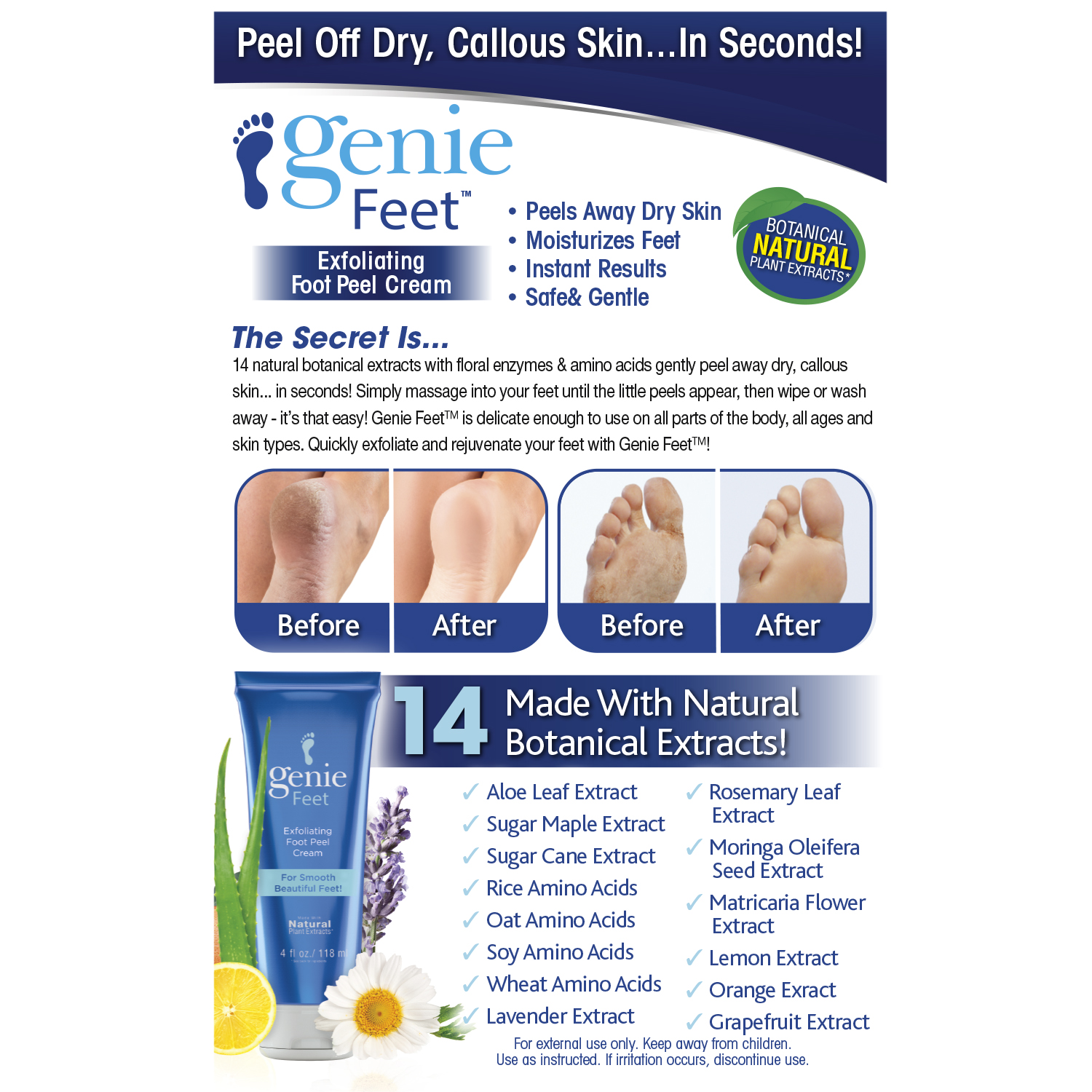 Genie Feet Exfoliating Foot Peel Cream for Smooth Beautiful feet, 4 oz.