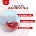 thumbnail image 2 of Colgate PerioGard Gum Care Toothpaste | Gum Problems | With Scientifically Proven Formula (90 gm), 2 of 4