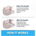 thumbnail image 4 of 2025 Advanced Anti-Snoring Solution, Soft Comfortable Mouthpiece for Quiet Sleep, Unisex Nighttime Snore Guard, 4 of 5
