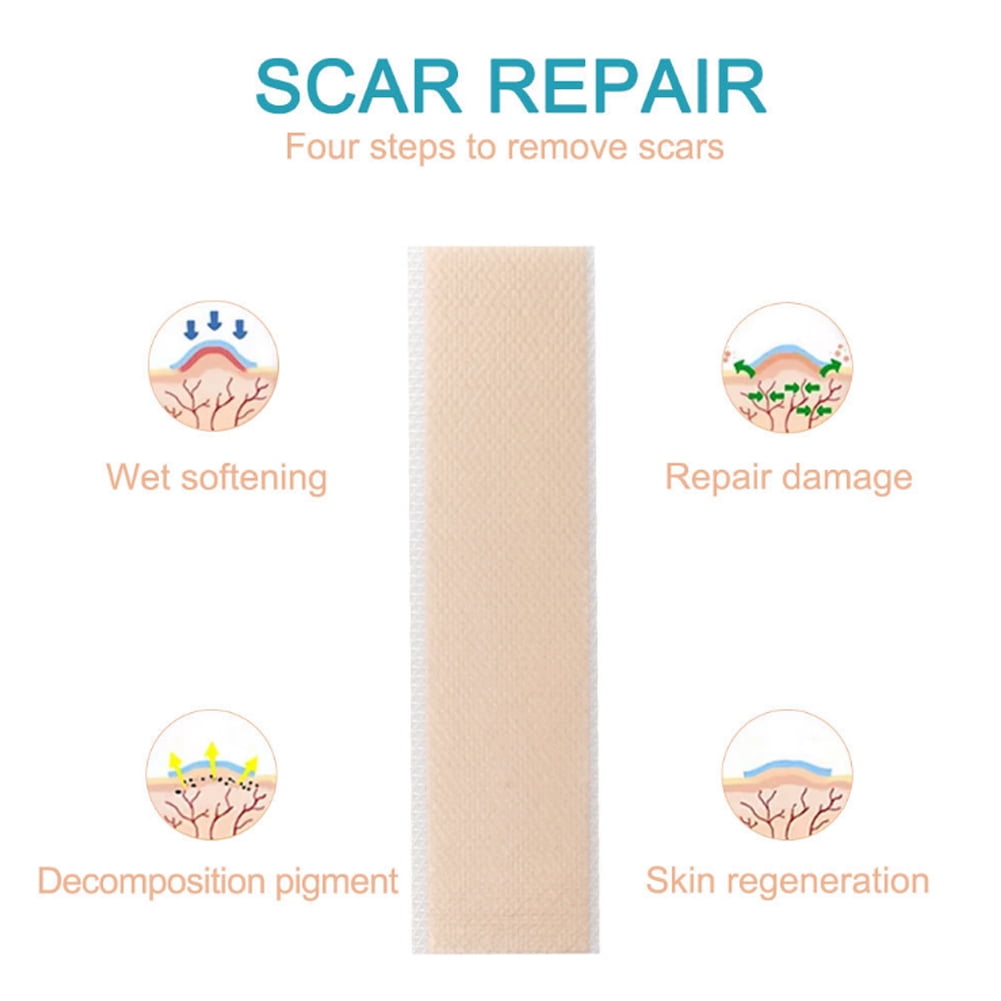 YLSHRF SelfAdhesive Scar Pad,ALIVER SelfAdhesive Silicone Scar Sheet