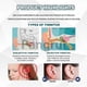 thumbnail image 2 of For Ear Tinnitus Sprayseffective Tinnitus Relief Spraytinnitus Relief For Earsear Spraytinnitus Trea, 2 of 5