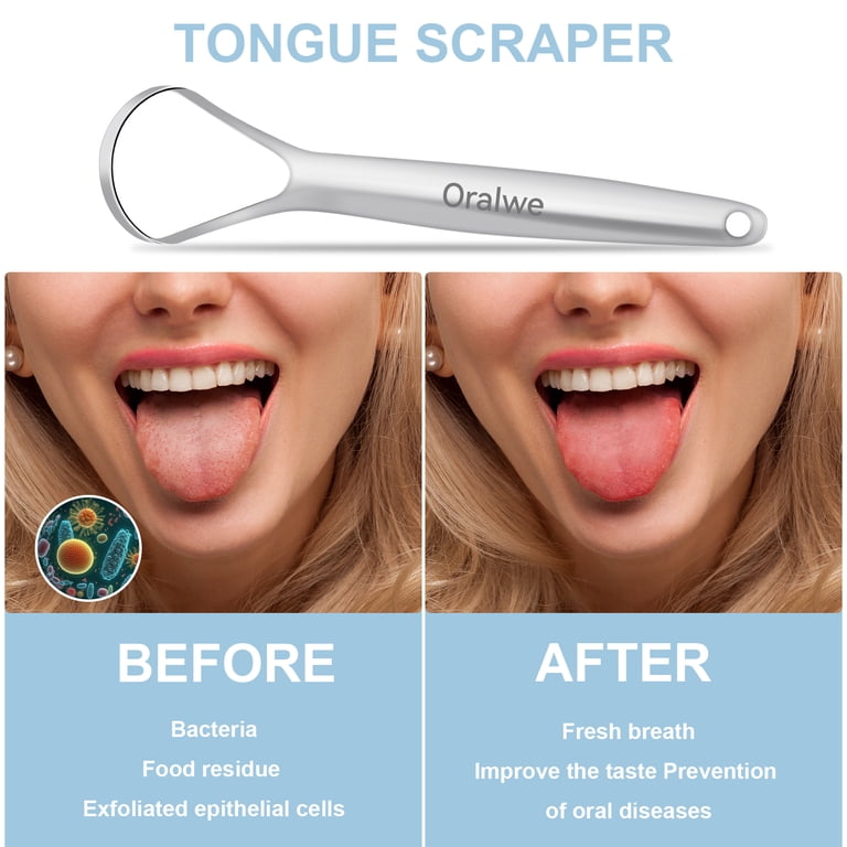 Stainless Steel Tongue Scraper, 2-Pack photo 5
