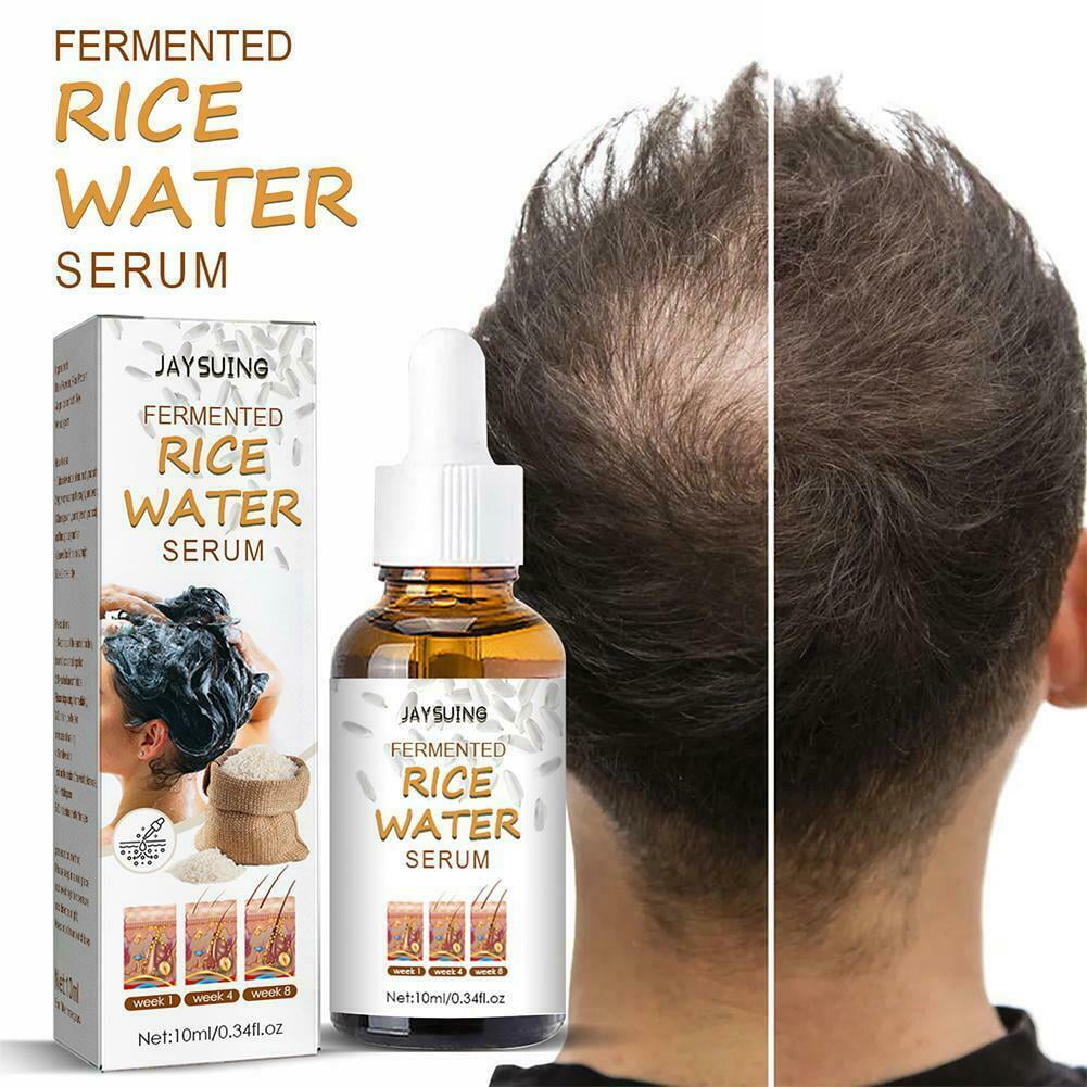 Fermented Rice Water Serum Hair Growth for Thinning Hair and Hair Losses Rice  Water Hair Essential Oil 0.35 fl oz - Walmart.com