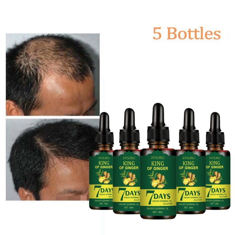 JANDEL 5 Pack Ginger Germinal Oil,2021 Hair Growth Ginger Essential Oil