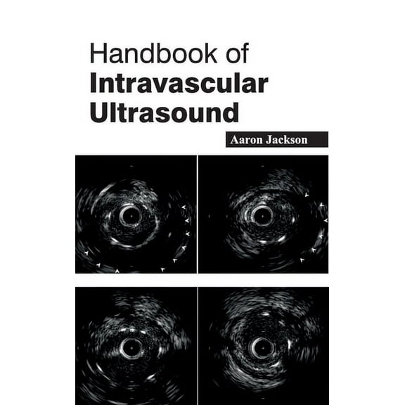 Handbook of Intravascular Ultrasound, (Hardcover)