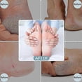 thumbnail image 4 of Stainless Steel Foot Scraper Metal Foot File Double SidedCallus Remover Professional for Wet or Dry SkinPedicure Tool Heel, 4 of 5