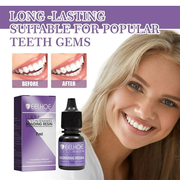 Tooth Gem Glue,gemstone Teeth Decoration Glue,professional Diy Tooth Gem  Glue,tooth Rhinestones Uv Light Hardening
