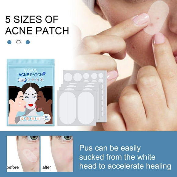 PVCS Acne Pimple Patches 5 Sizes 80 Patches For Large Breakoutsacne Patches For Face Chin Or Body Acne Treatment With Tree And Calendula Oil Hydrocolloi Bandages