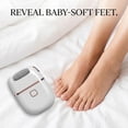 thumbnail image 3 of Electric Foot Exfoliator, Callus Remover for Feet with Sanding Wheel, Portable Electric Foot File for Dead Skin, Type-C Rechargeable, White, 3 of 6