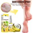 thumbnail image 3 of Foot Care Foot Spray Anti-drying and Moisturizing Banana Coconut Foot Care Spray for Dry and Rough Skin, 3 of 9