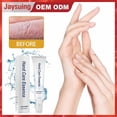 thumbnail image 1 of Esencia para el cuidado de manos hialurónica antienvejecimiento 40 ml HUOGUO, 1 of 4