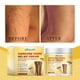 thumbnail image 2 of Bee Venom Vein Repair Cream 100G Relieves Leg Fatigue and Improves Venous Circulation, 2 of 5